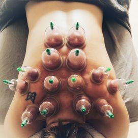 Cupping2